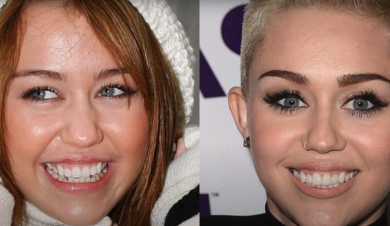 Miley Cyrus did share a dental x-ray